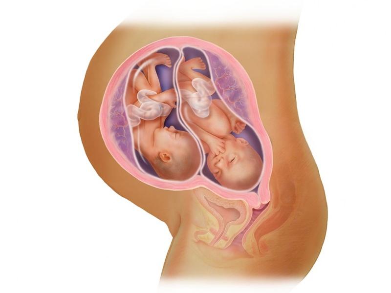 Tüp bebekte ikiz gebelik! Embriyo transferi nedir?