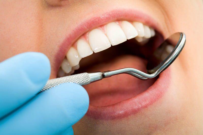 Diş ağrısı tedavisi nedir? Diş ağrısı nasıl geçer?