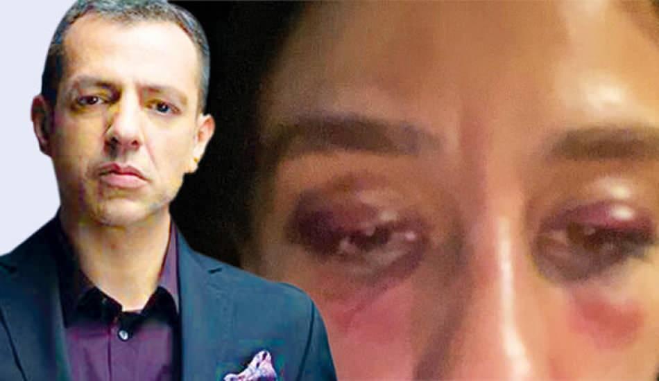 nisanlisina_siddet_uygulayan_rubato_grubunun_solisti_ozer_arkunun_isleri_elinden_alindi_1594800813_4384.jpg