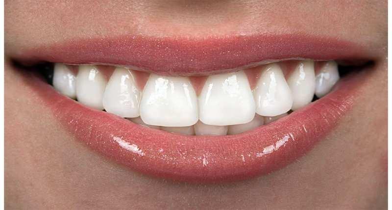 Sightseeing utilsigtet Allerede Rüyada diş görmek ne anlama gelir? Rüyada yeni dişin çıkması neye işarettir  - Pratik Bilgiler Haberleri