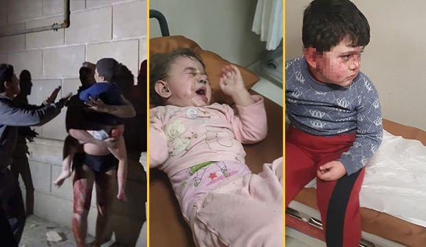 Ermenisyan'ın Gence'ye saldırısında yaralanan çocuklar